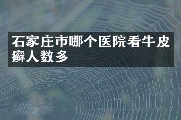 石家庄市哪个医院看牛皮癣人数多