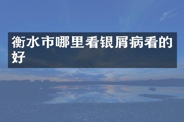 衡水市哪里看银屑病看的好